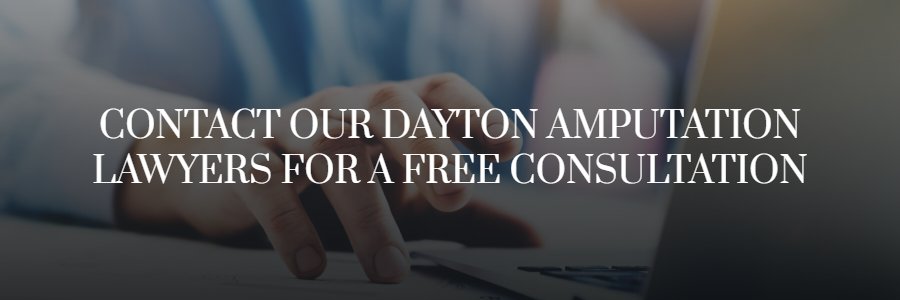 Dayton amputation attorney