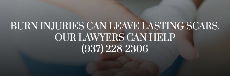 Dayton serious burn injury lawyer